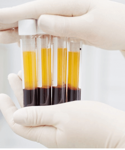 Medical Sample
