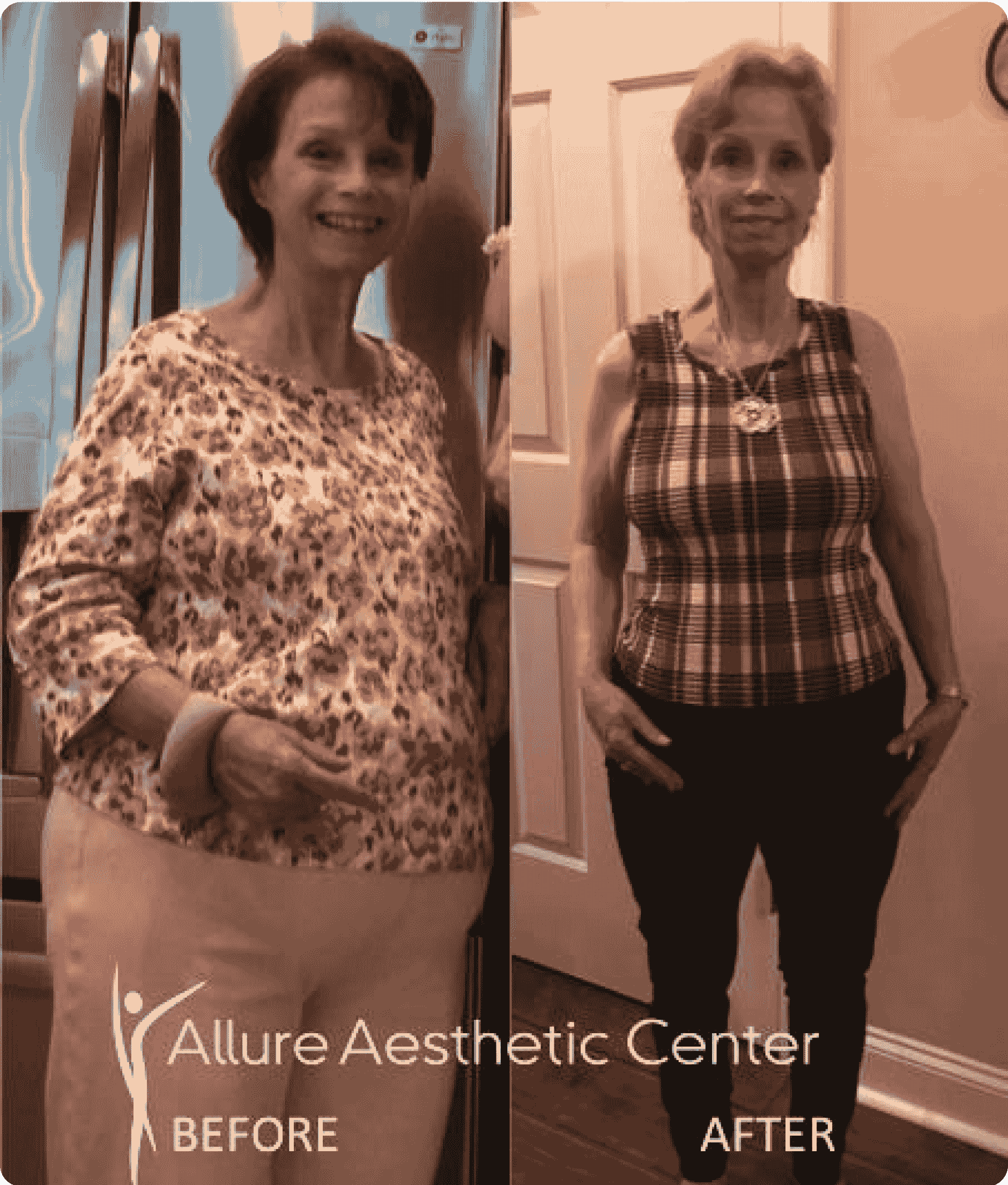 hCG weight loss atlanta