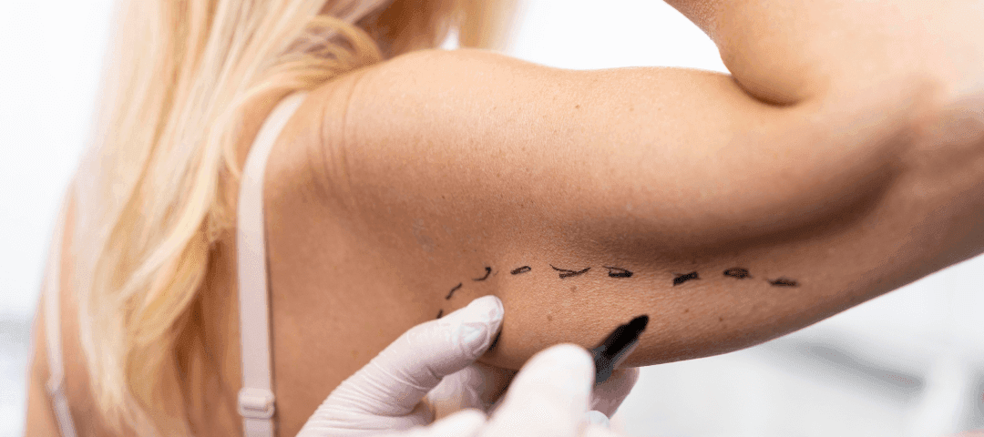 Combining Fillers and Body Sculpting For Full Body Rejuvenation