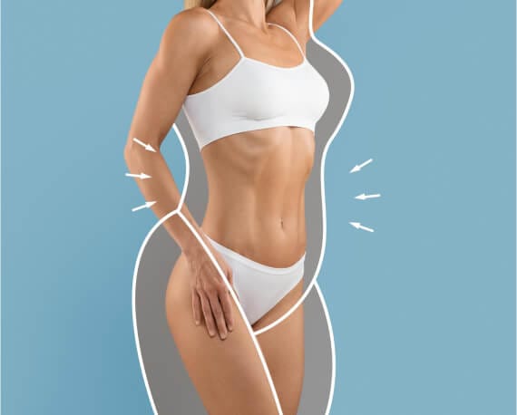 Cryolipolysis