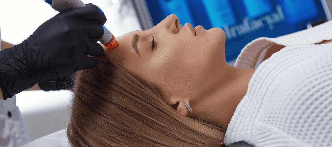 What is Microdermabrasion?