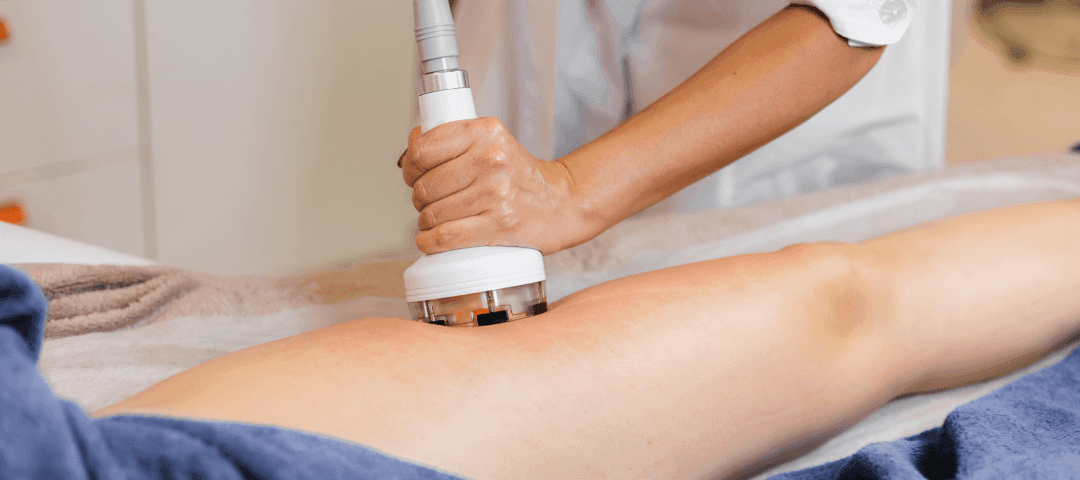 Understanding the Cost of Shockwave Therapy and Insurance Coverage
