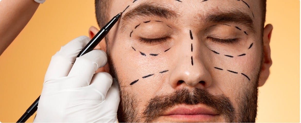 Botox Among Male Client