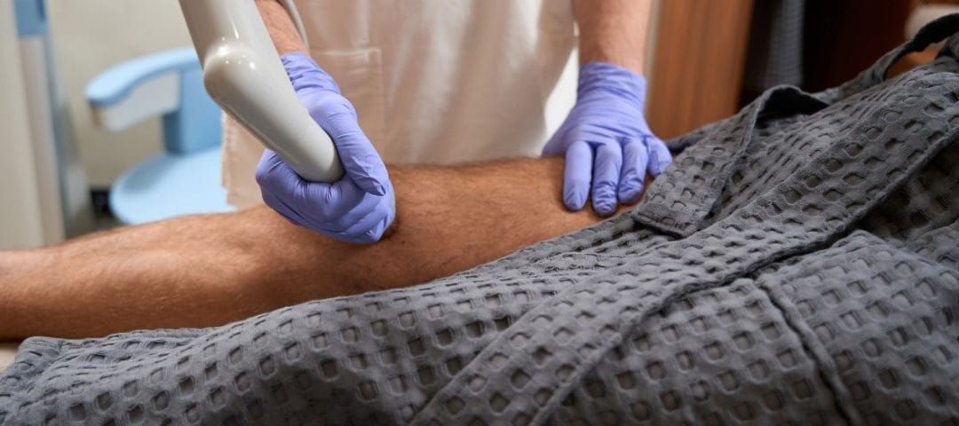 Success Rate of Shockwave Therapy for ED