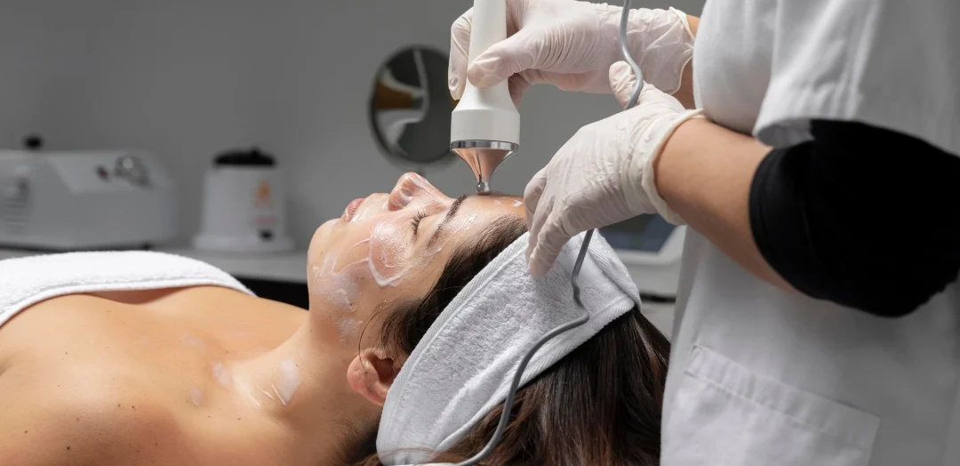 CO2 Laser For Sun Damage: Sunspots and Pigmentation Treatment