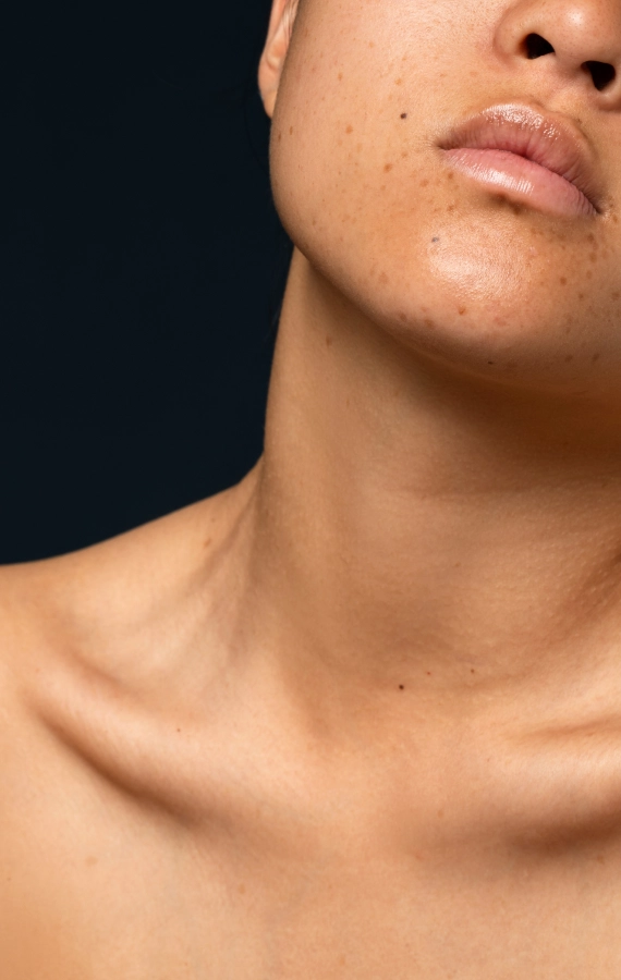 sunspot cropped area