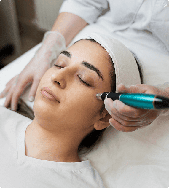 Benefits-RF-Microneedling
