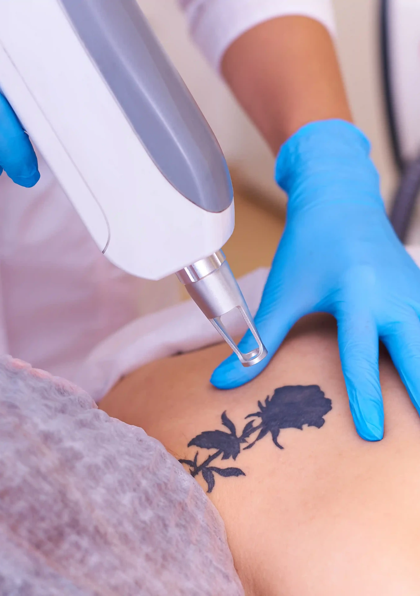 Tattoo removal process