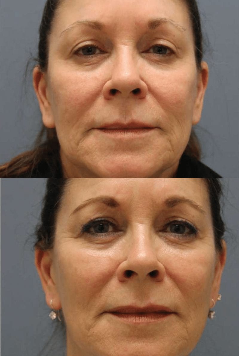 old lady vs young lady