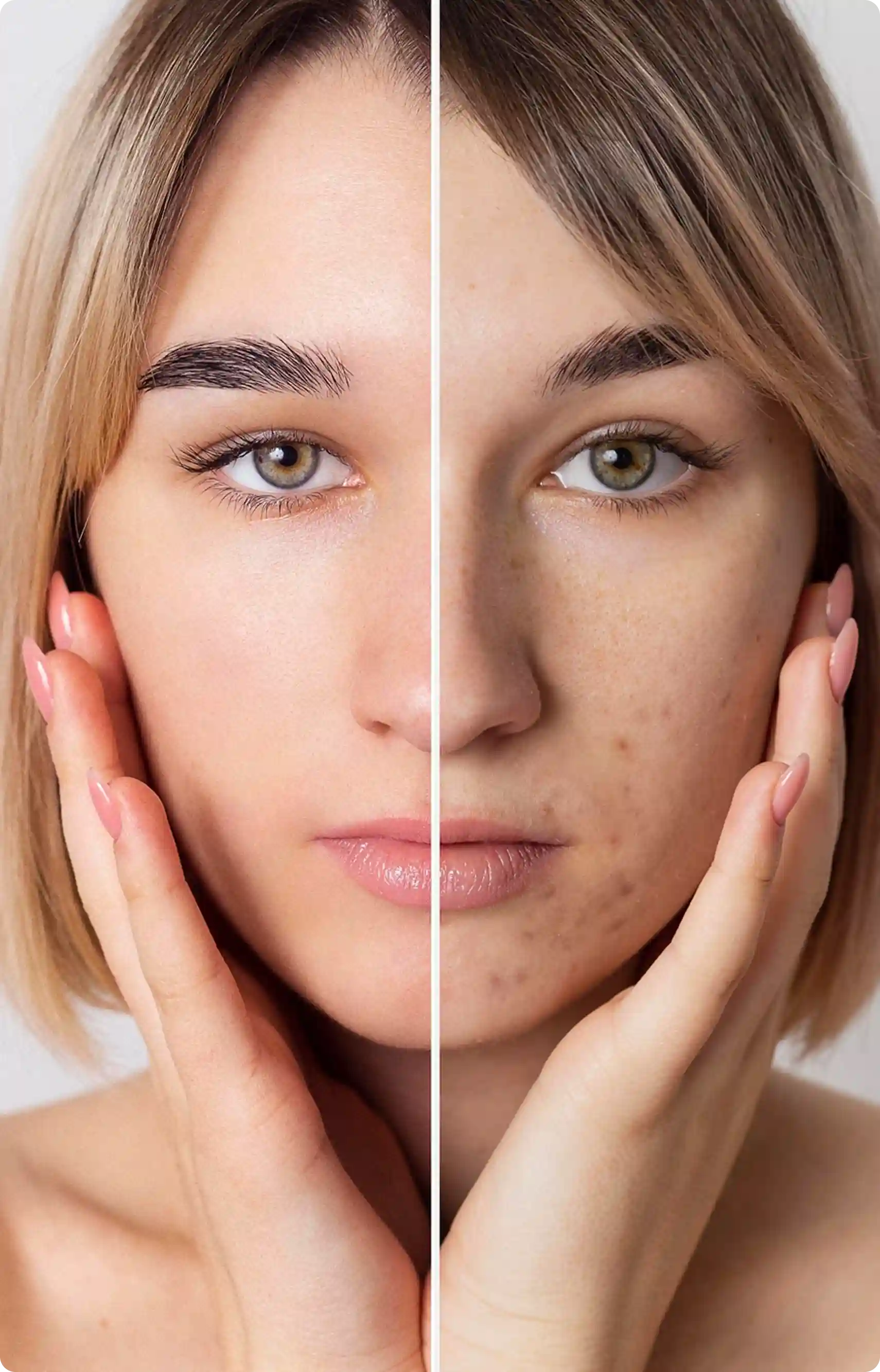 Laser Skin Resurfacing Safe