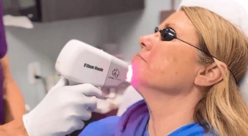 Utilizing-diode-laser