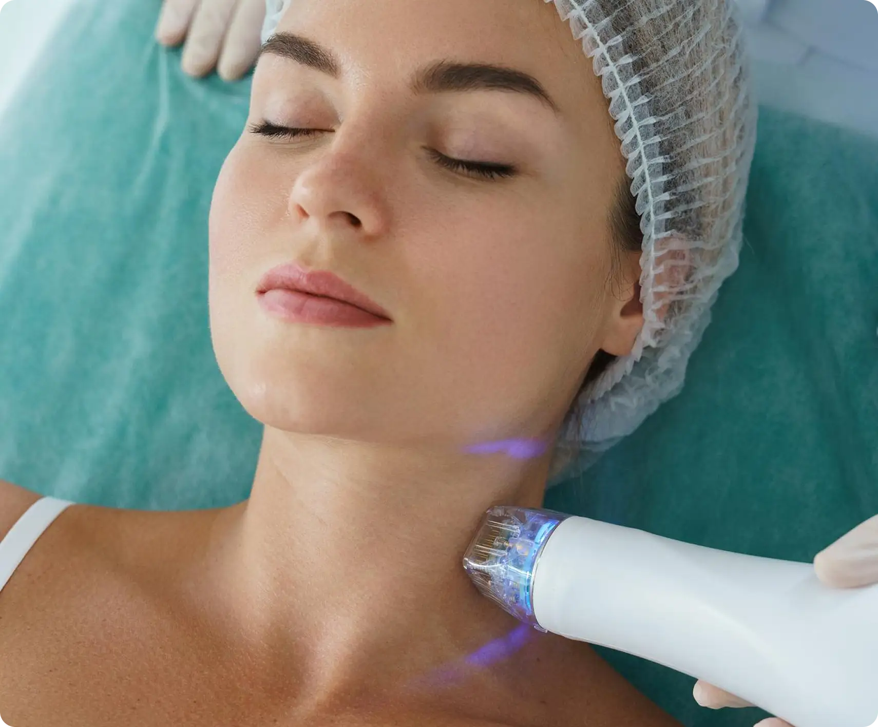 What is CO2 Laser Treatment