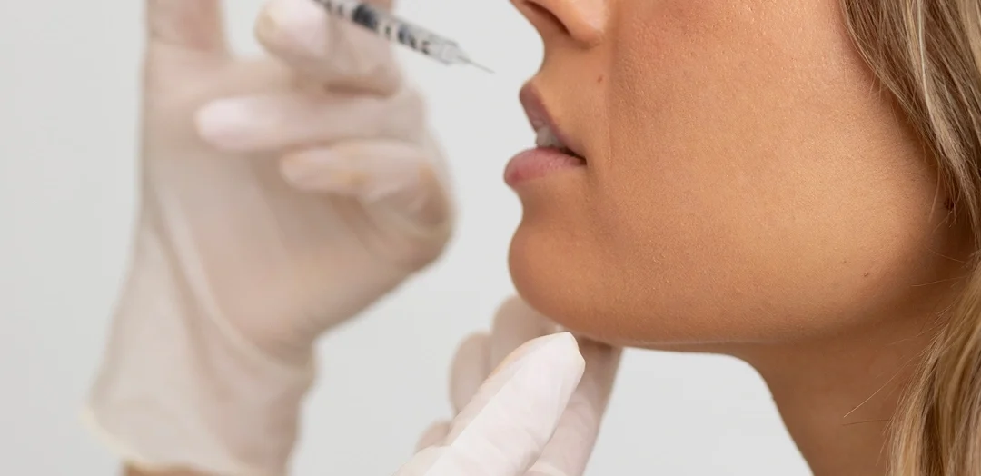 First-Time Lip Fillers: What to Expect Before, During, and After