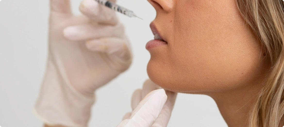 Lip Fillers: A Quick Overview